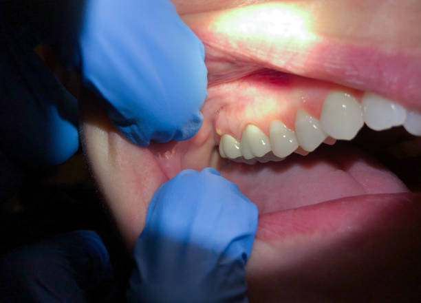 Best Holiday Emergency Dentist in Rancho Mission Viejo, CA