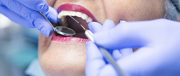Best Emergency Dentist for Knocked-Out Tooth in Rancho Mission Viejo, CA